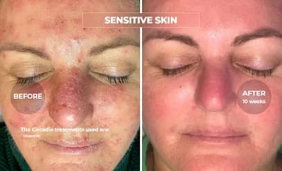 Lameena Spa - Head Spa