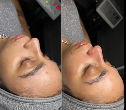 Rejuva Glow Beauty - Head Spa