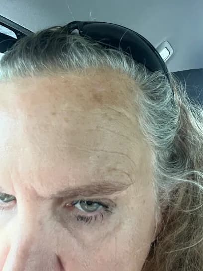 Honest MedSpa - Head Spa