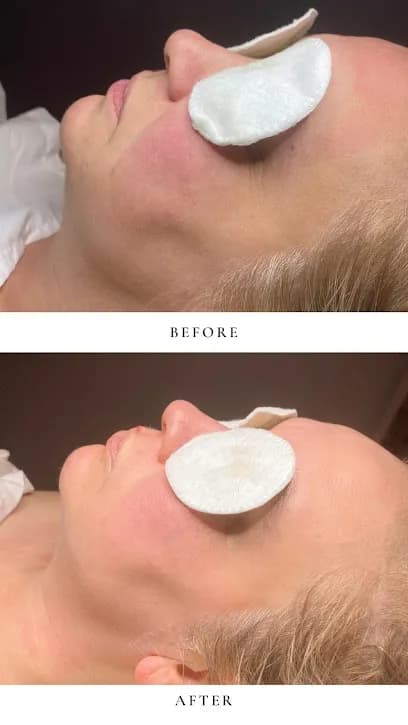 Identity Skin Spa - Head Spa