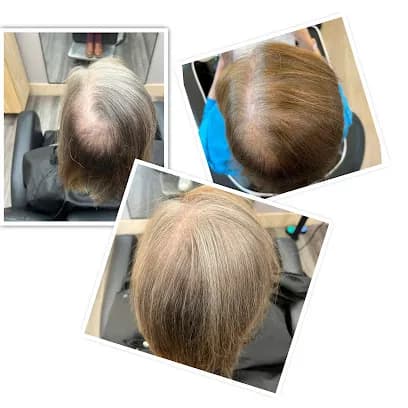 Black Opal Wellness - Head Spa